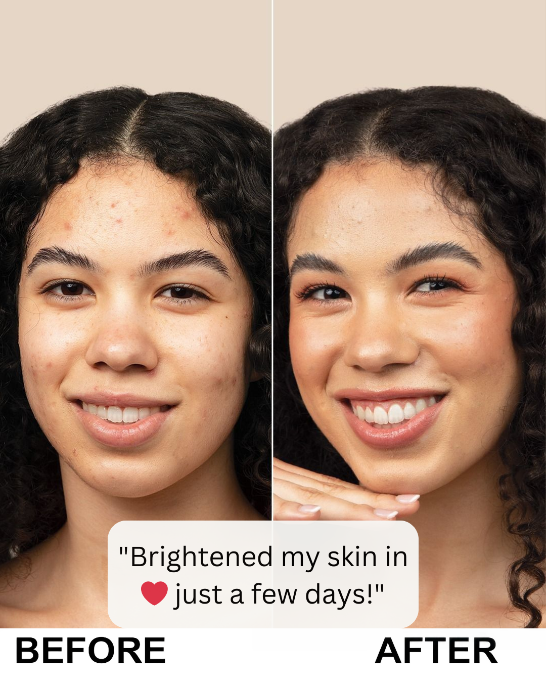 Rice Glow Peel Serum