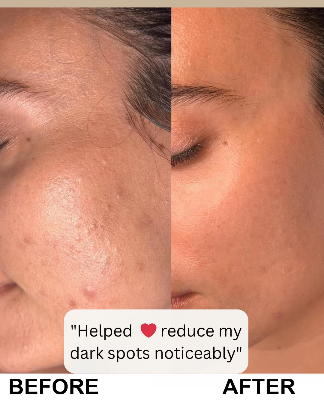 Rice Glow Peel Serum