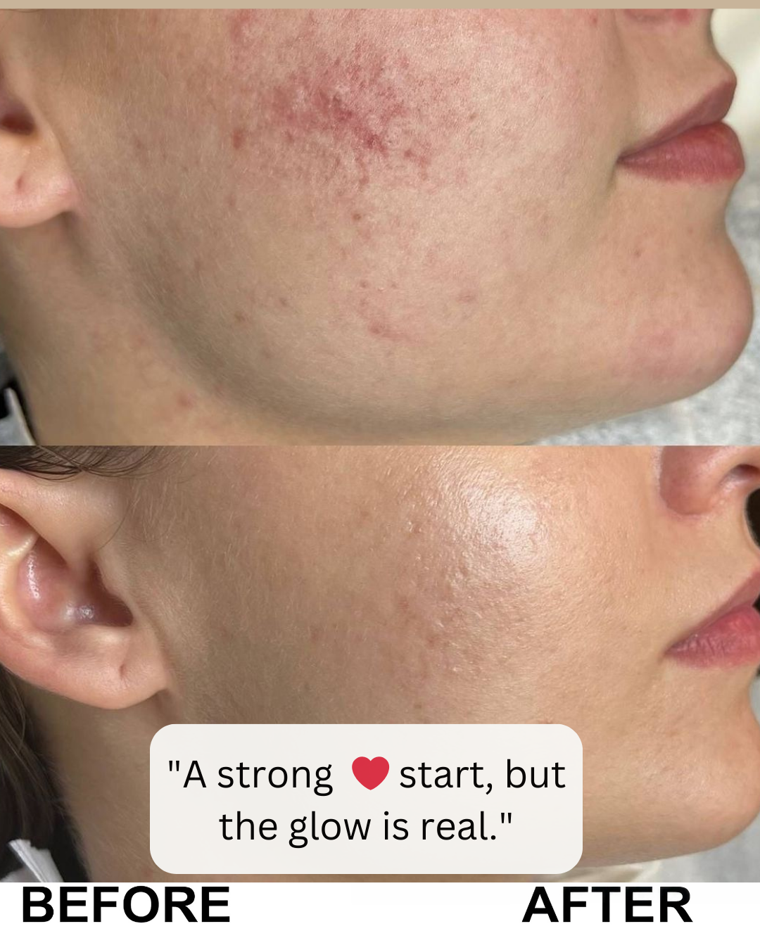 Rice Glow Peel Serum