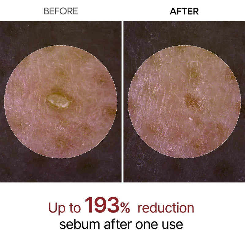 Rice Glow Peel Serum