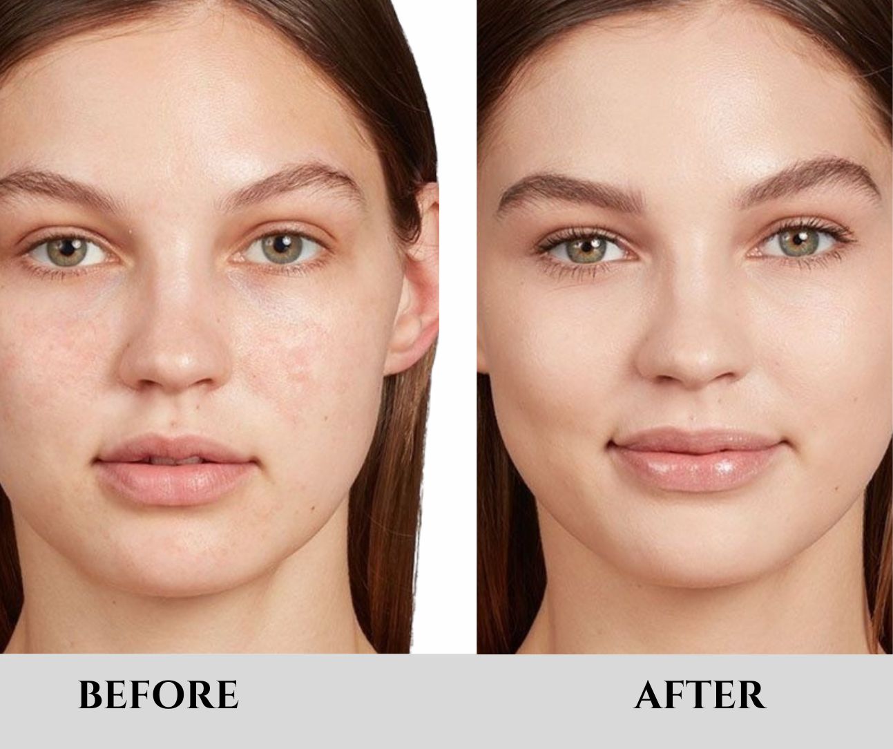 Rice Glow Peel Serum