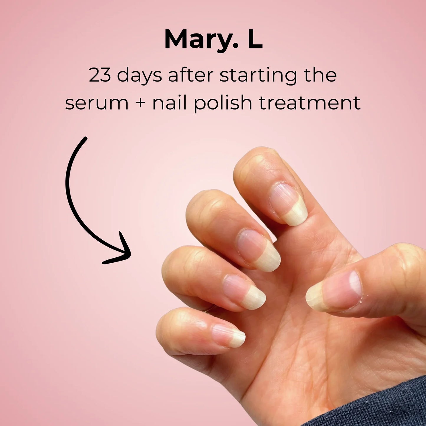 Nail Growth Serum