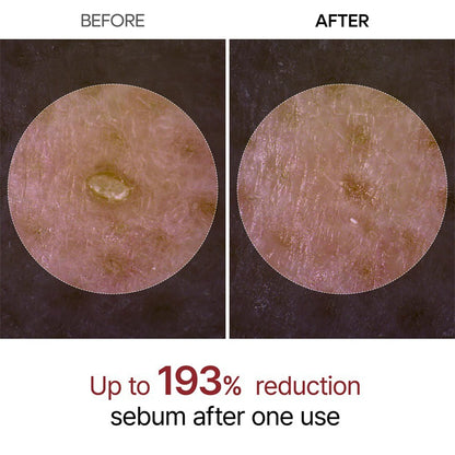 Rice Glow Peel Serum